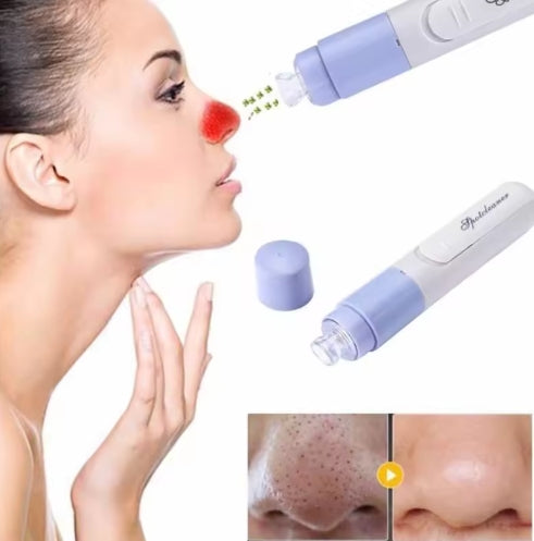 SUCCIONADOR DE PUNTOS NEGROS